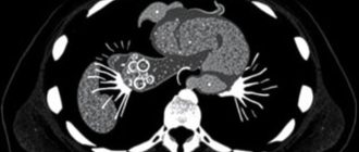 КТ печени: что это, как подготовиться и когда результат можно считать надежным